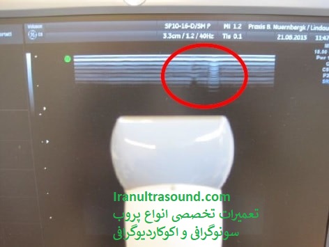 خرابی کریستال پروب سونوگرافی 