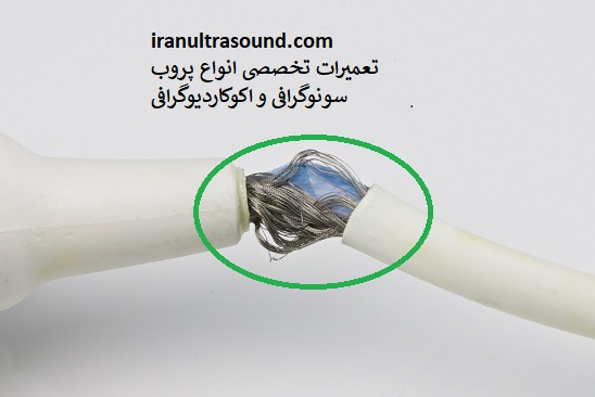 پارگی کابل پروب سونوگرافی