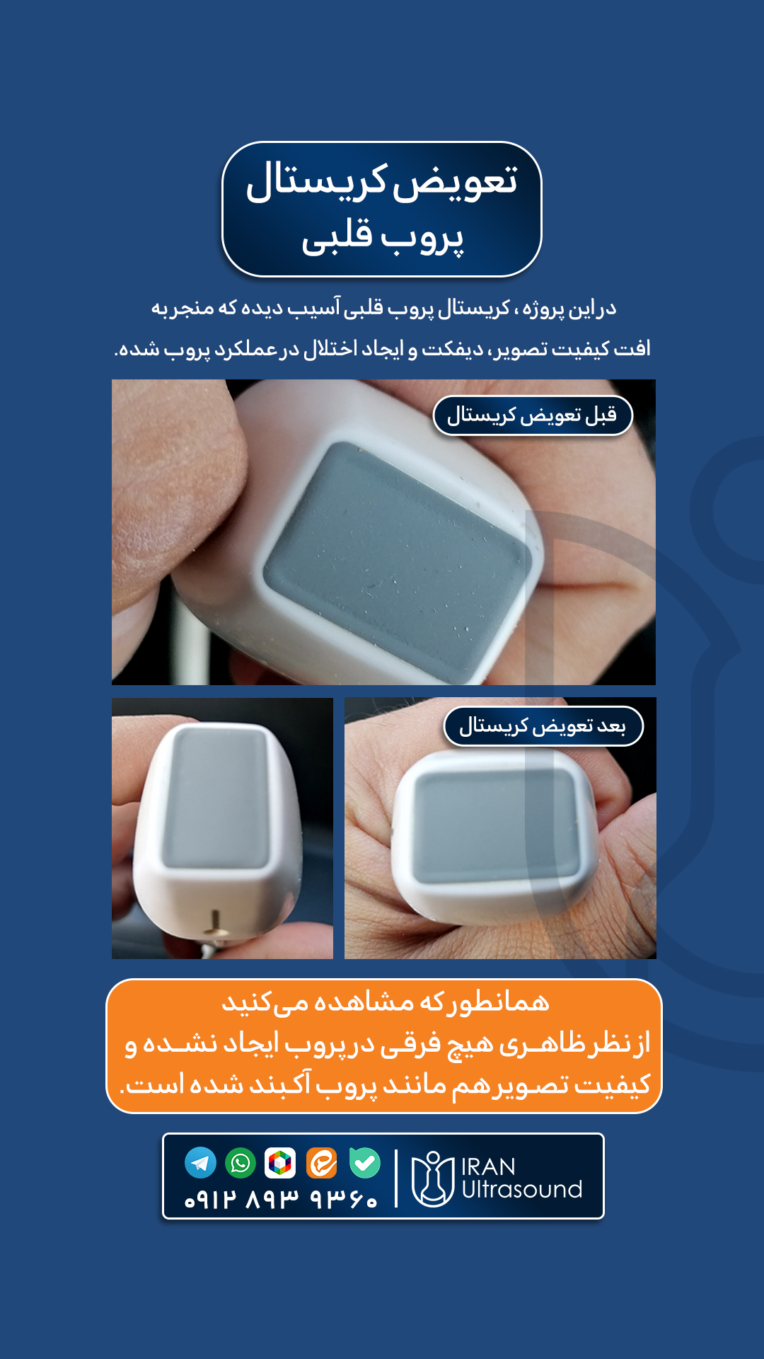 تعویض کریستال پروب قلبی (Phase Array)